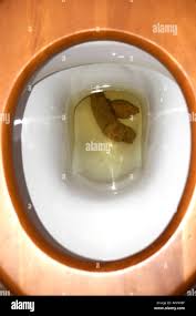 Shitalot